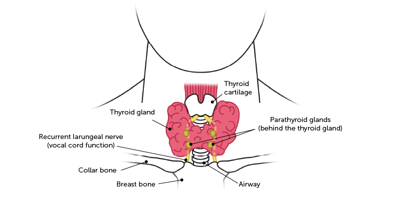 Thyroidectomy surgery picture