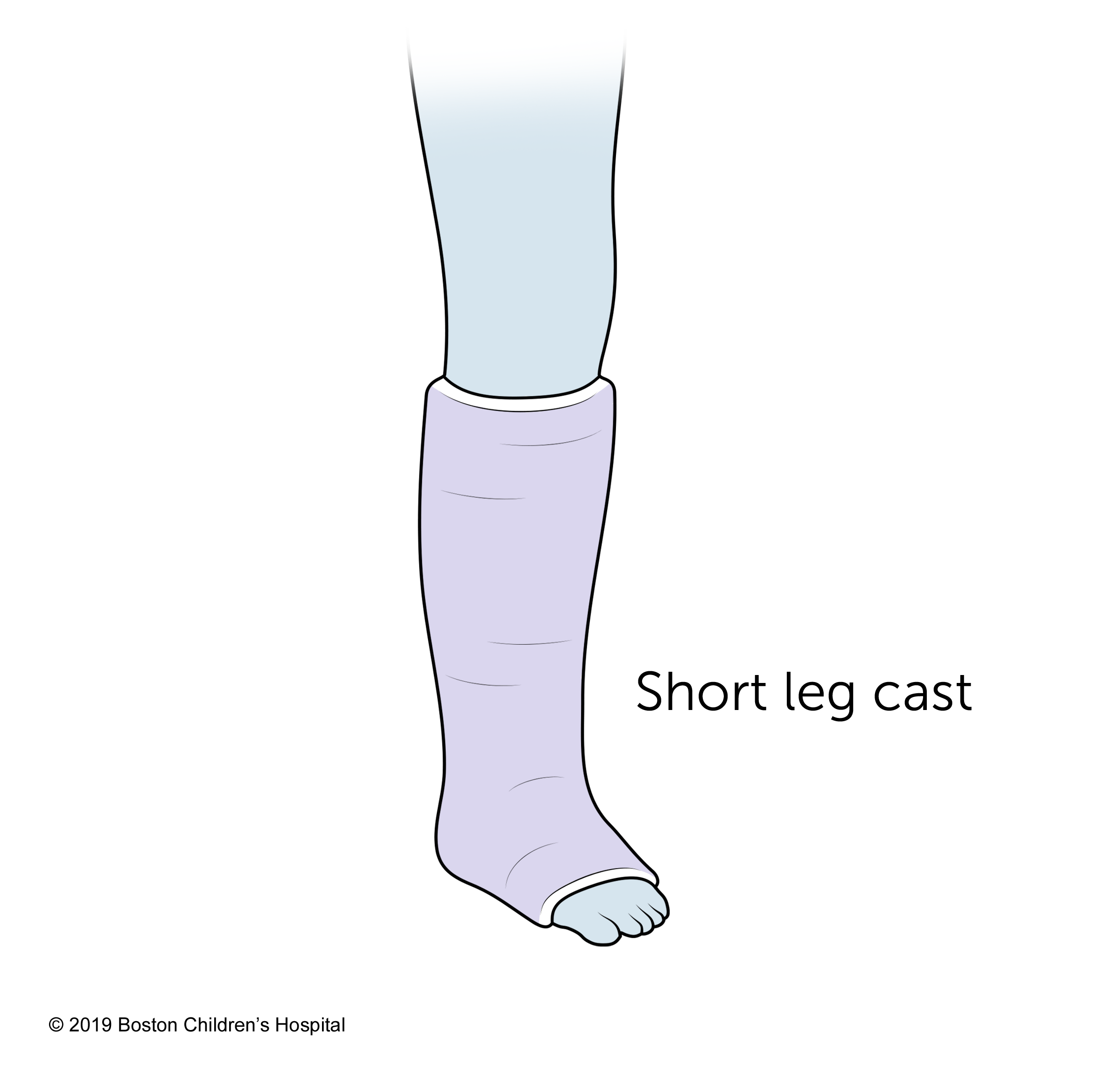 A short leg cast.