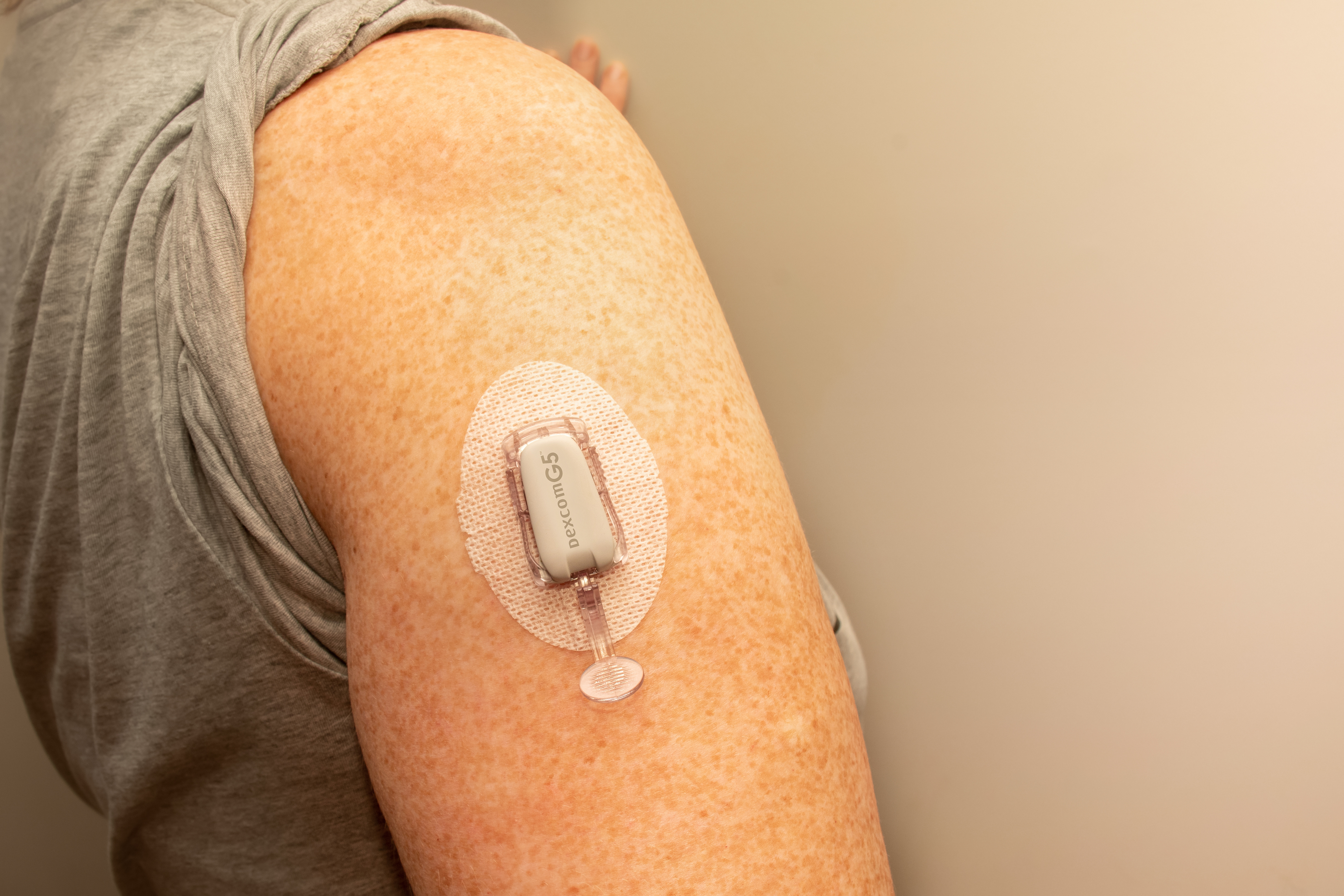 A close up image of an arm with a rolled up grey sleeve to show off their diabetes patch.