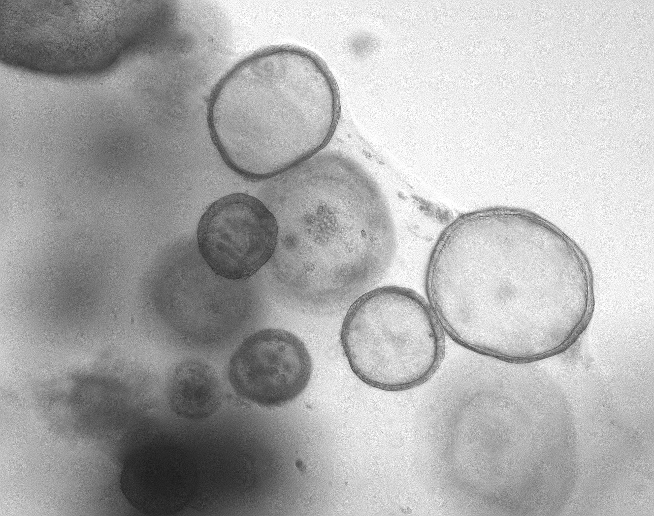 Grey microscopic image of Human Intestinal Organoid cells.