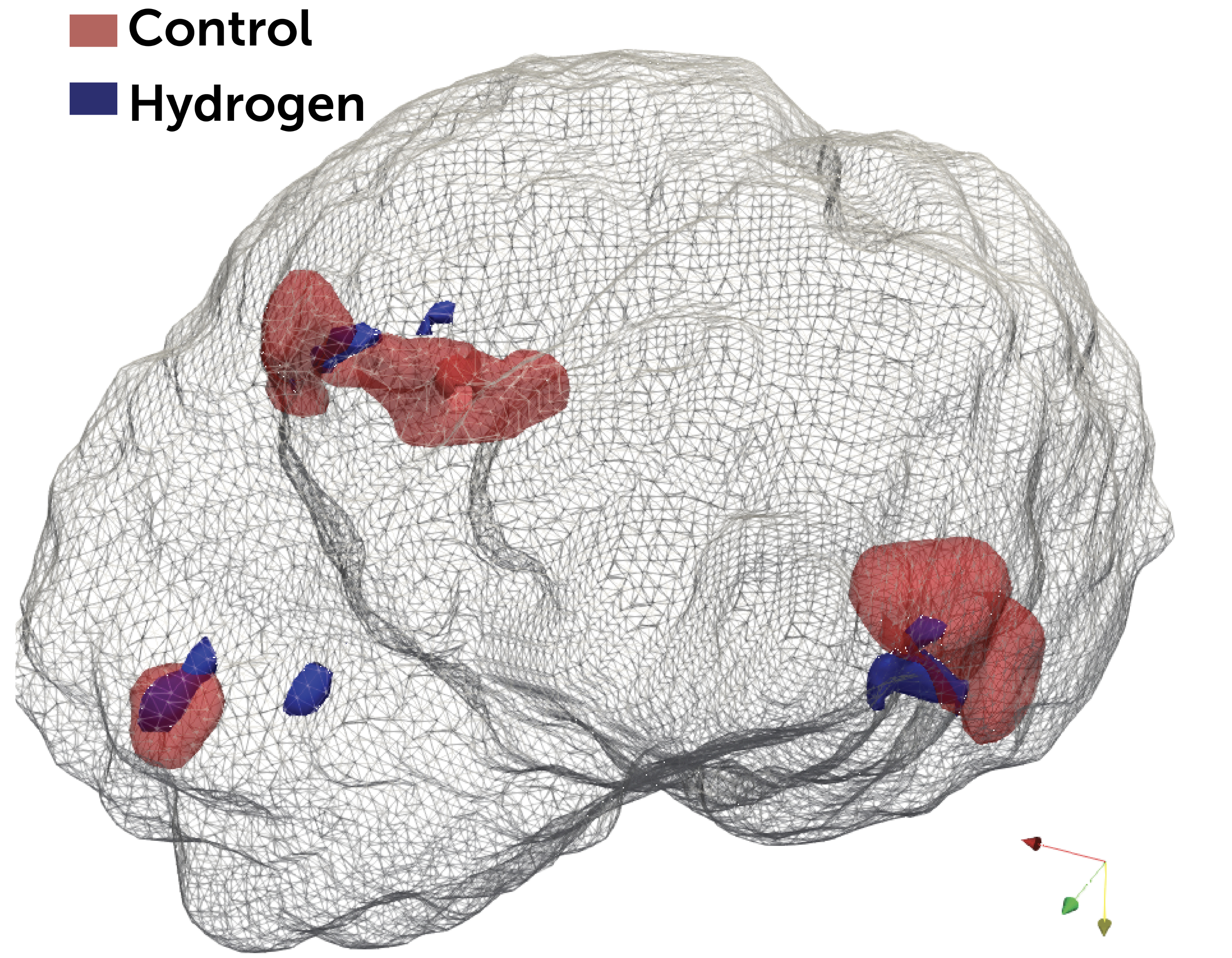 3D rendering of a brain with the parts highlighted in red and blue that the oxygen will target when using ECMO.