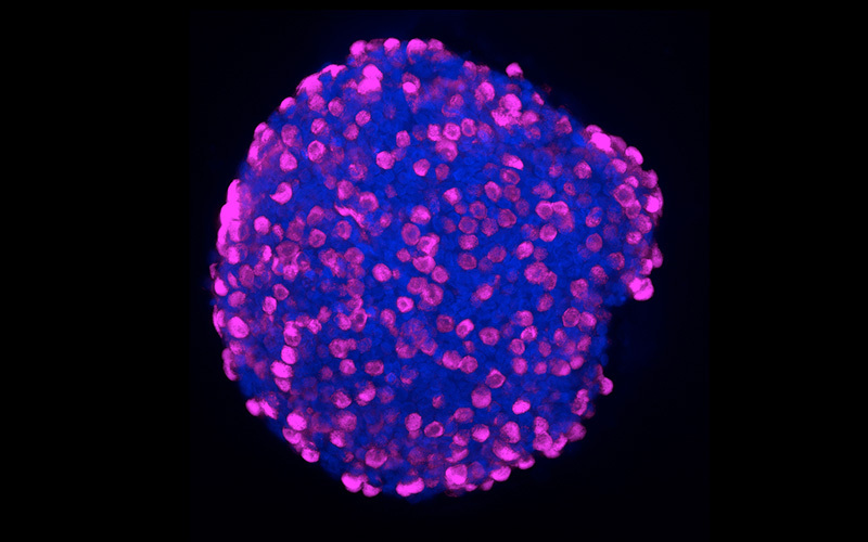 Image of enteroendocrine cells