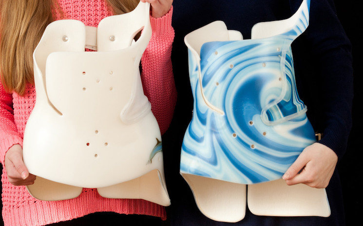 A girl holds two scoliosis braces.