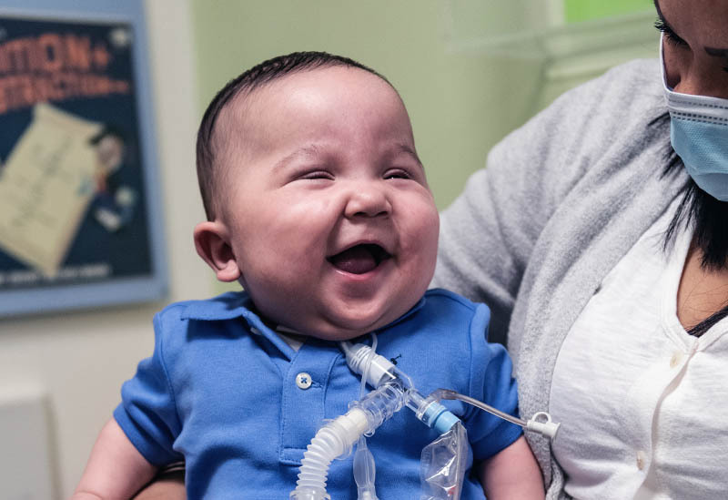 A baby with a ventilator protruding from his throat smiles up at his mother.