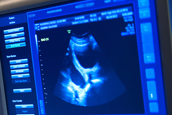 Image of fetal ultrasound
