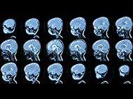 eighteen brain scan images