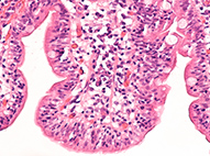 intestine cells