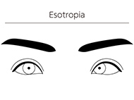 drawing of a pair of eyes with one crossed