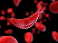 Red microscopic sickle cells on a black background.
