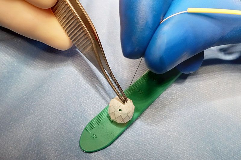 Clinician uses tweezers to touch part of the body