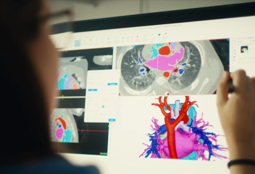 Clinicians review three-dimensional imaging of the heart