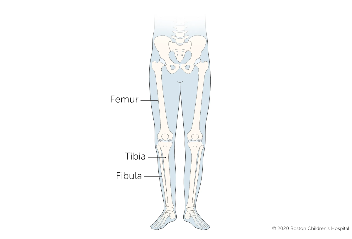 Image of the three long bones in the leg: the femur, the tibia, and the fibula.