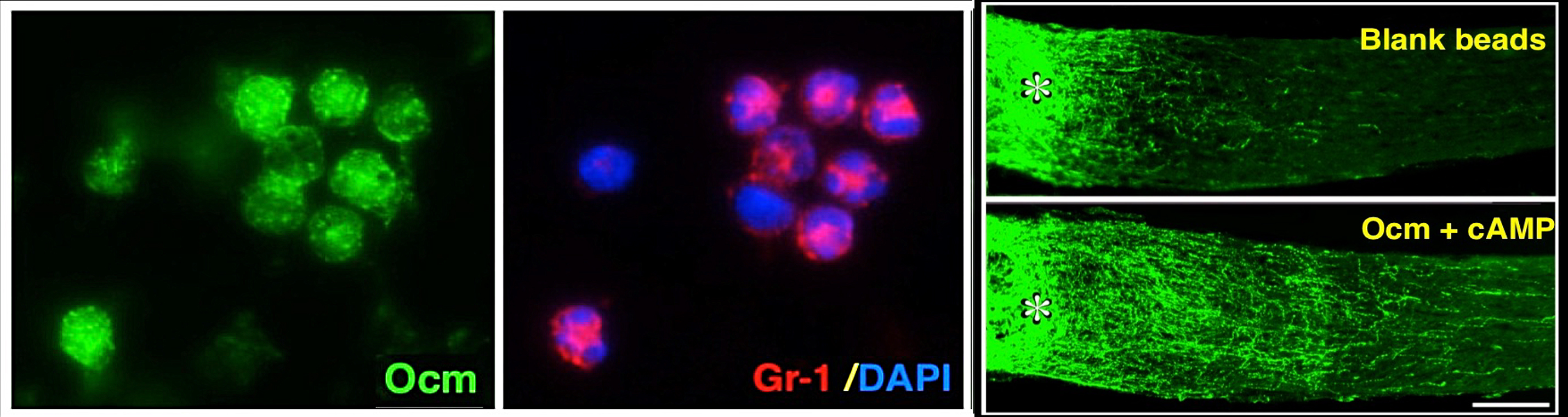 Four panels showing the microscopic process of inflammation and regeneration.