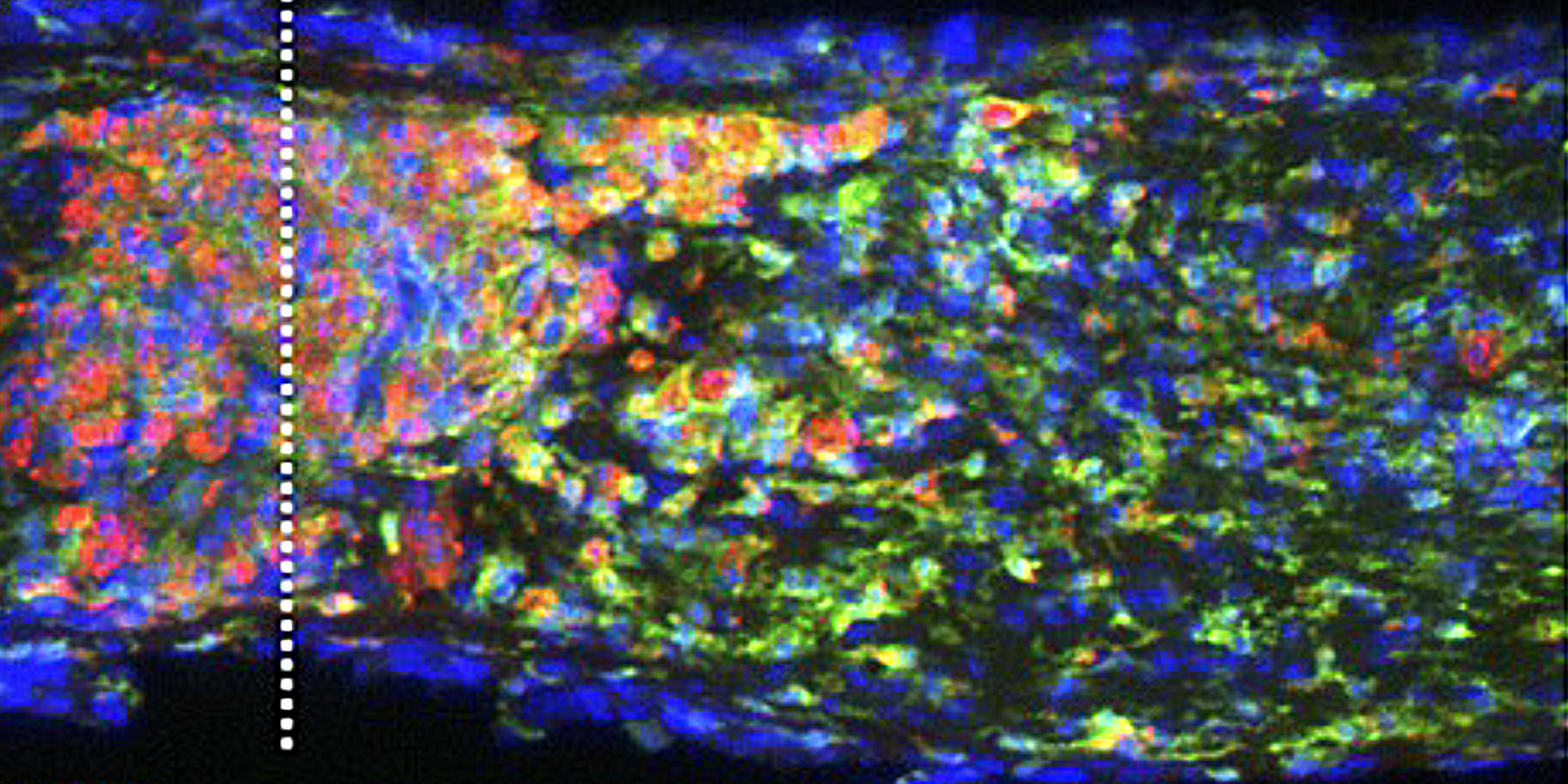 A colorful rendering of inflammation and regeneration at the cell level.