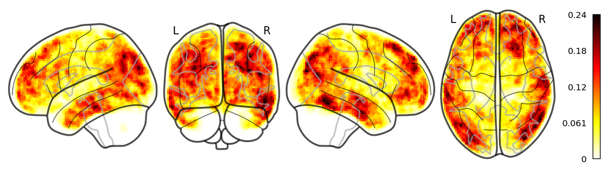 Advanced neuroimaging and neurophysiology in Tuberous Sclerosis Complex_LNM2