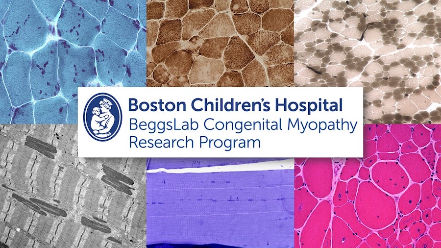 Beggs lab logo of woman holding child surrounded by six squares of different colored cells