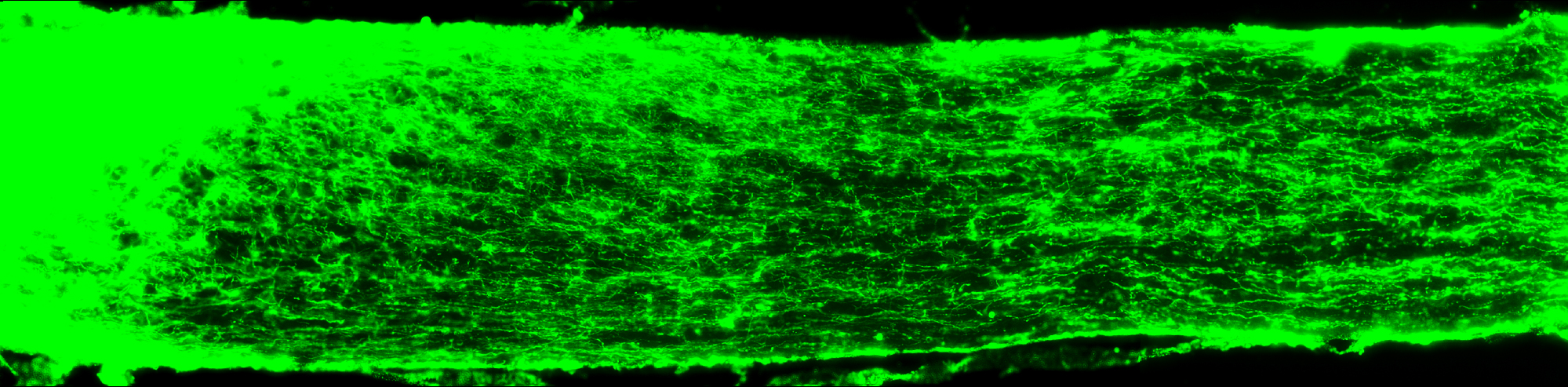 Microscopic rendering of optic nerve cells tearing apart.