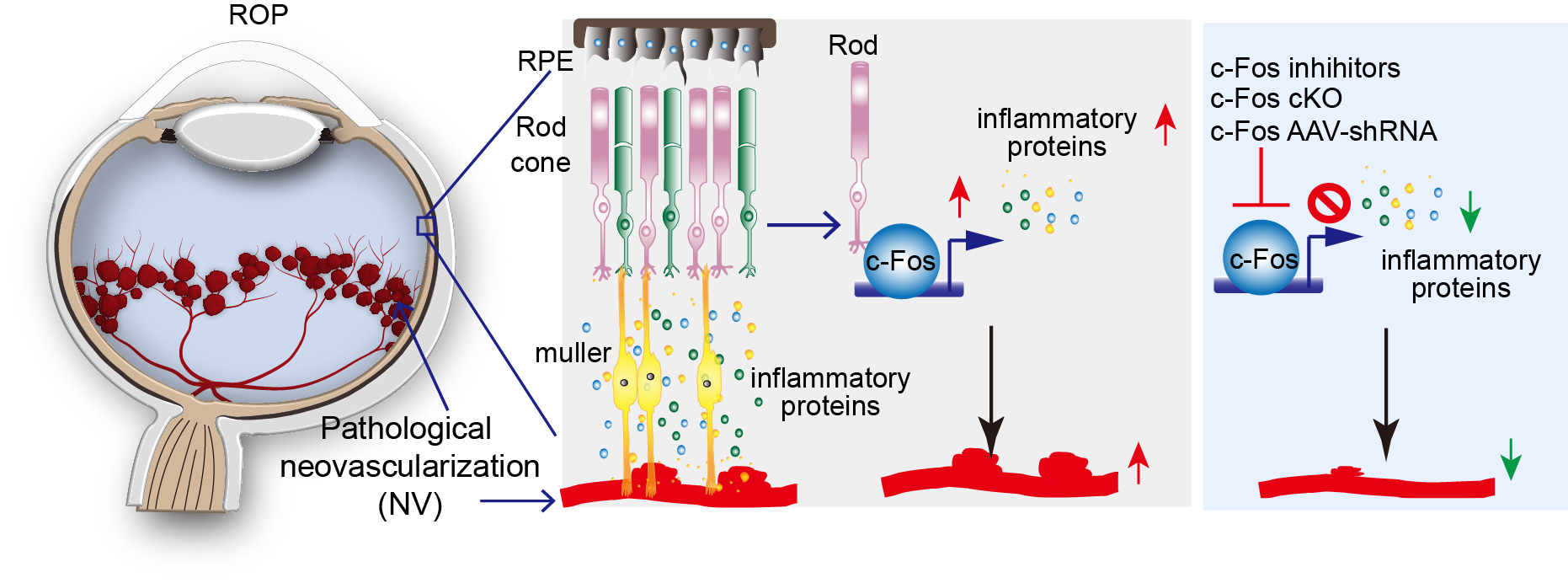 A large scale drawing of what's behind the pupil of the eye with red veins and red clusters of small dots at the bottom which are the pathological neovascularization (NV); above this is a dark blue square labeled RPE which holds the rod cone, muller, rod, c-fos, and inflammatory proteins; the c-Fos has c-Fos inhihitors, c-Fos cKO, and c-Fos AAV-shRNA.