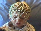 Child wears electrodes for scan