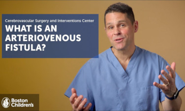 Video card: What is an arteriovenus fistula?