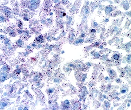 normal liver cells
