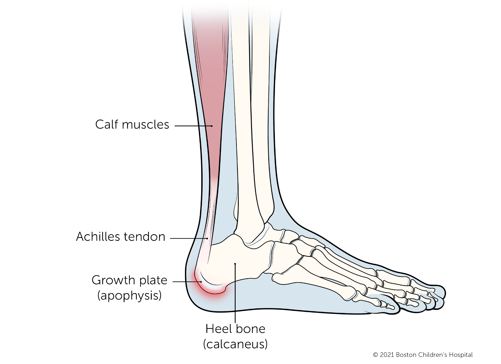 Plantar Fasciitis and Menopause | Harley Street at home