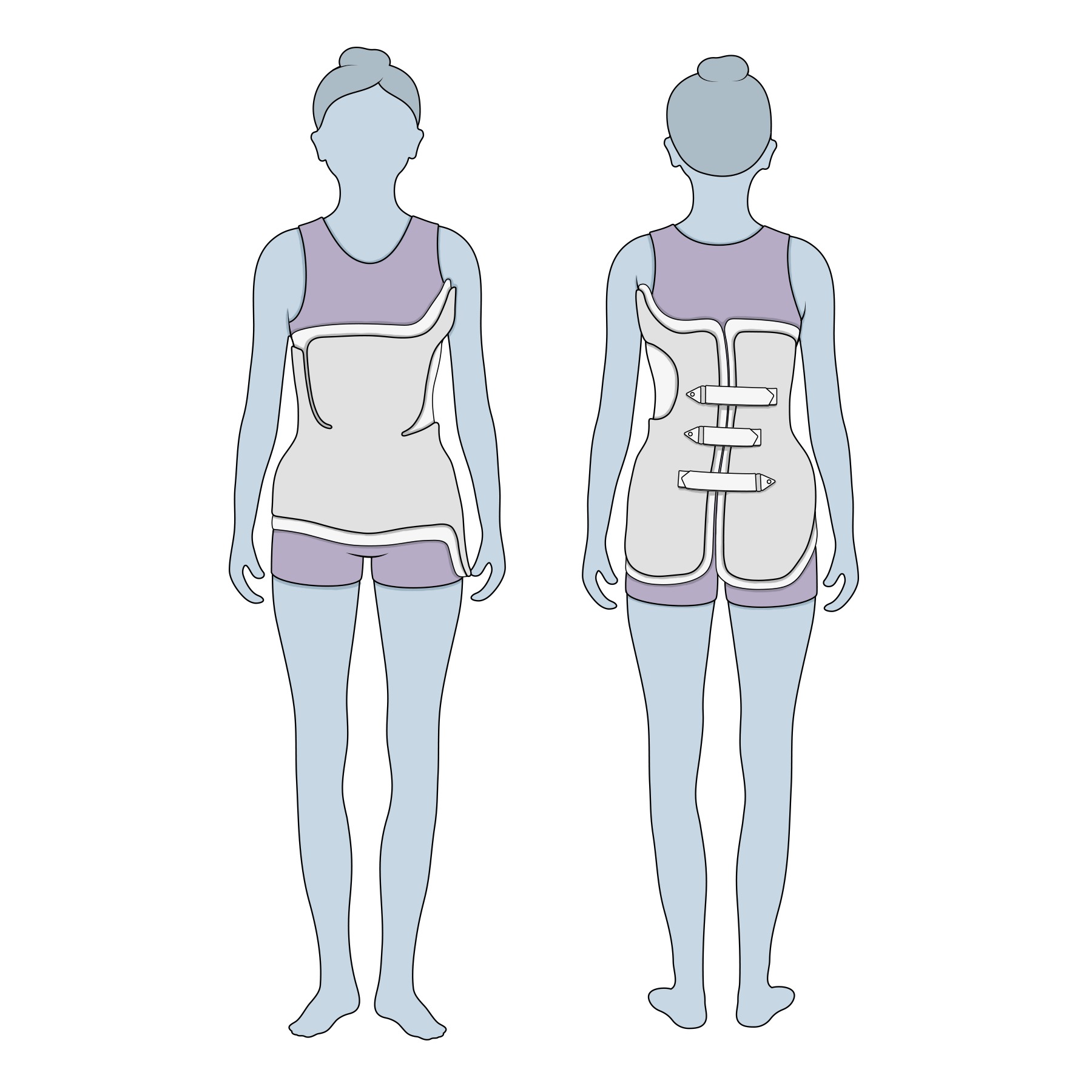 Molded Jackets: A Type of Spinal Brace