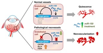 Schematic of Mir150 in Pathological NV