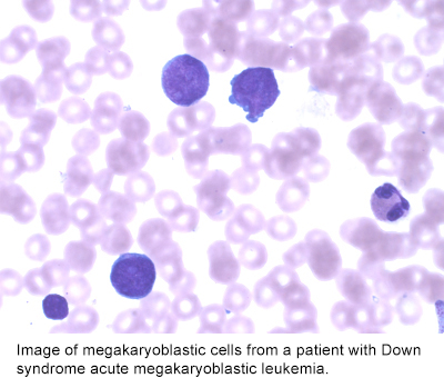 Dyregulated Gene Expression in Leukemogenesis