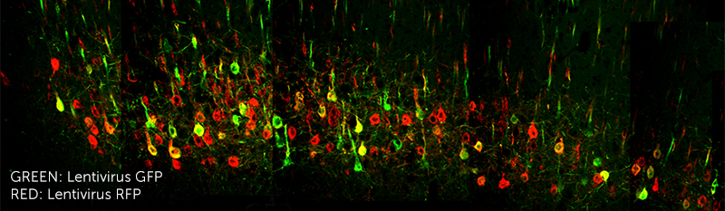 mouse-brain-cortex with lenti GFP and lenti RFP