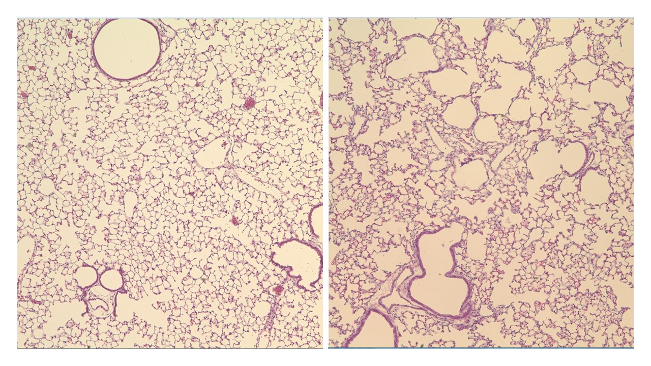 Two mouse lung tissue sections showing enlarged alveoli in the SELENON knockout mice (seen on the right) compared to the wild type mouse (on the left).