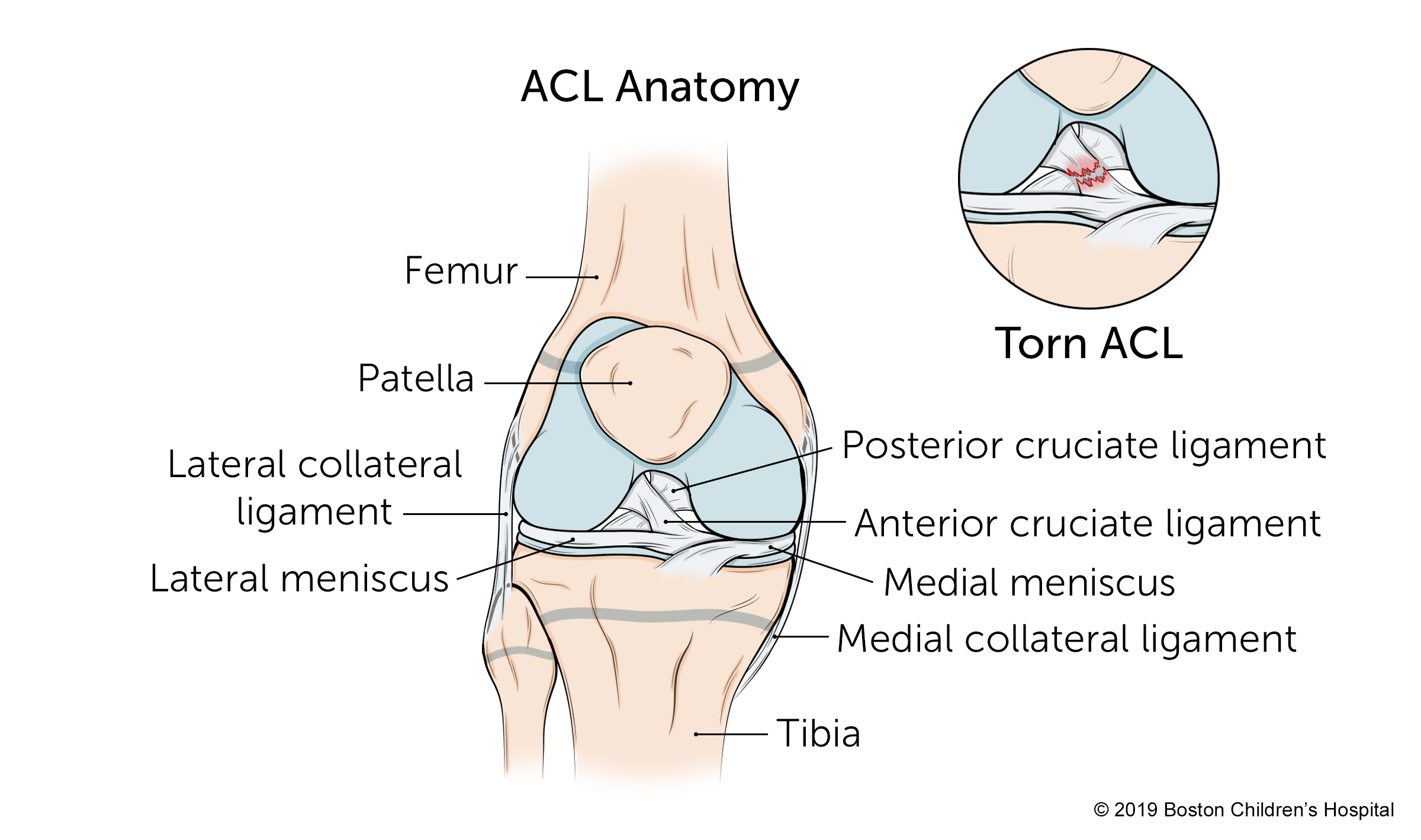 A look at the anatomy of the anterior cruciate ligament, or the ACL.