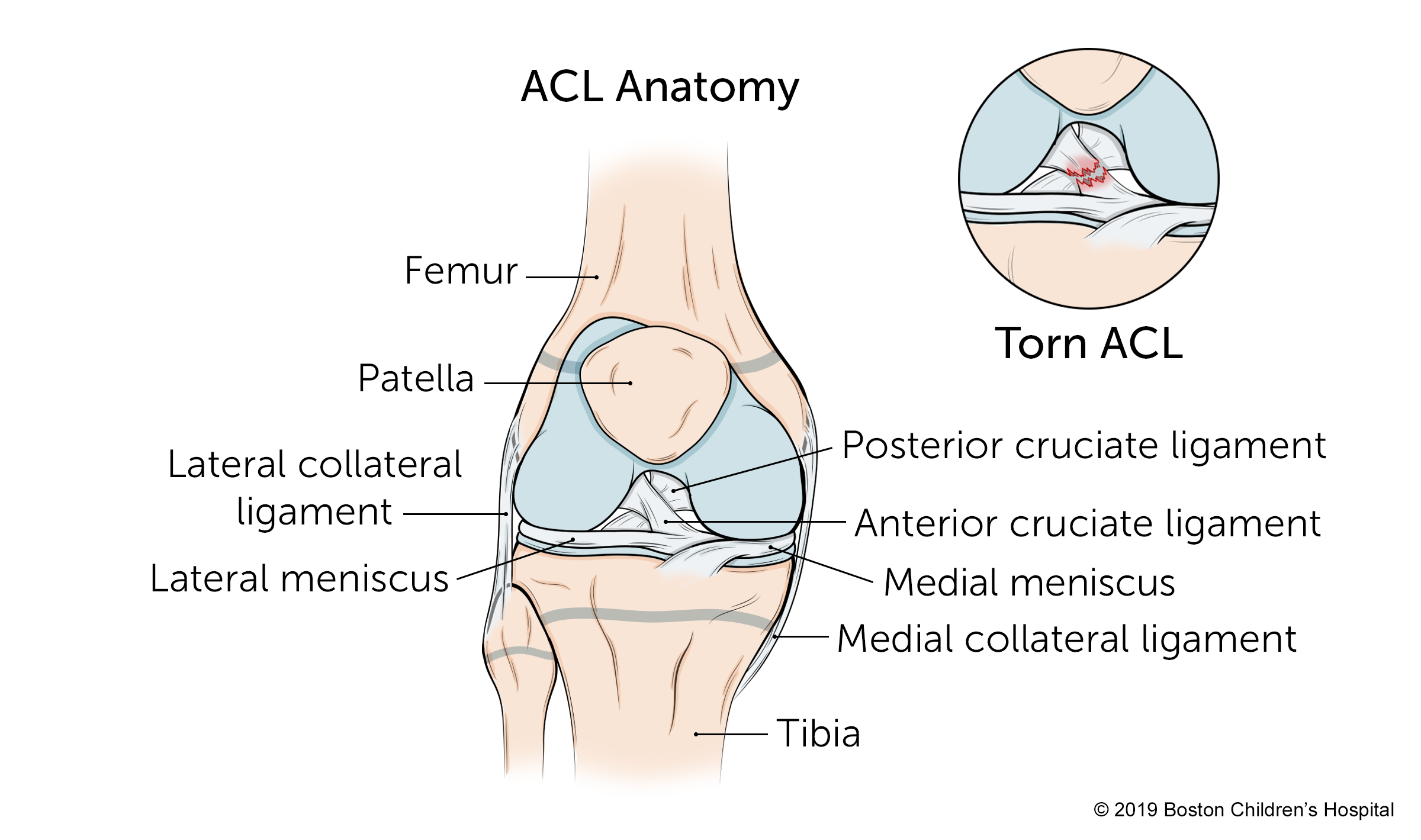 Everything You Need to Know About Anterior Cruciate Ligament (ACL