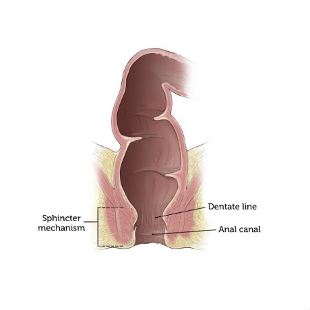 Healthy Colon after Pull-through Procedure