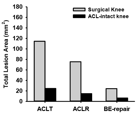 Surgical knee versus ACL Intact Knee