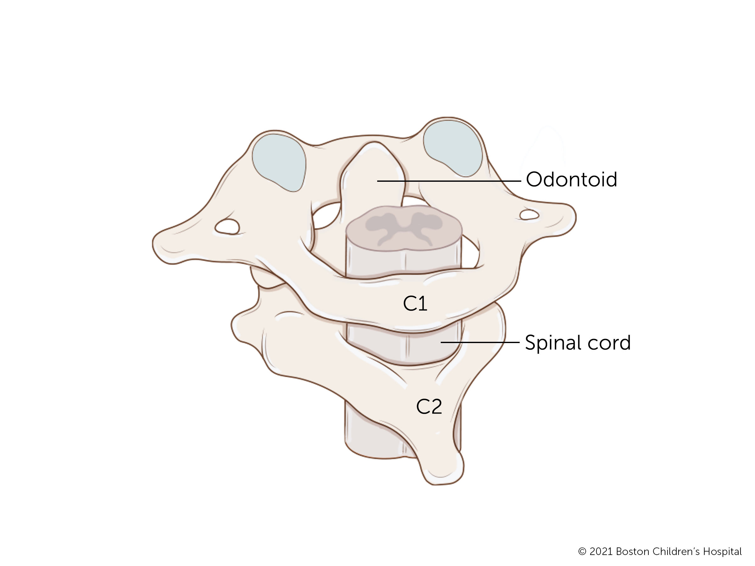 The C1 and C2 vertebrae at the top of the spine are connected by a nob called the odontoid process.