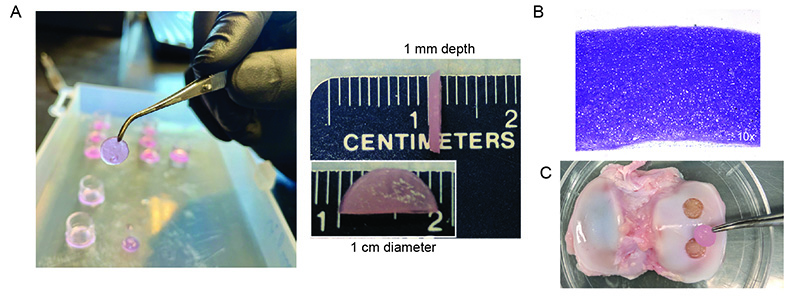 Figure: Following successful repair of rodent joint cartilage (Gardner et. Al, 2019), we are excited to continue our translational studies in a large animal model. (A) We are engineering cartilage with defined thickness and diameter for preclinical studies. (B) Histological cross sections of articular cartilage generated from heSCs stains metachromatically with toluidine blue dye indicating the presence of proteoglycans. (C) Example of minipig joint surface (tibial plateau) in which we created full thickness focal cartilage defects (5 mm diameter). Held in forceps is a size-matched biopsy punch of a hESC-derived cartilage tissue construct created in the lab.
