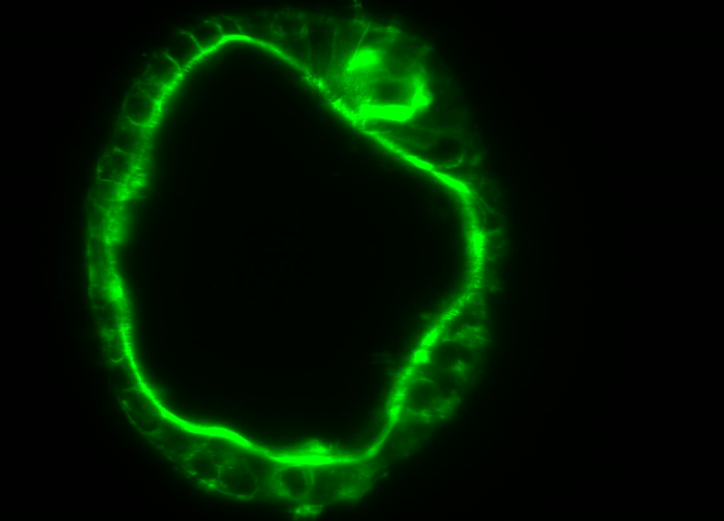 Lightsheet imaging of human primary TTC7A deficient enteroid stained with actin showing a multiple lumen phenotype. (Thiagarajah Lab)