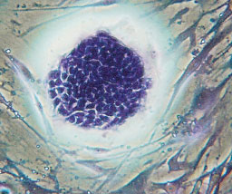 Lung Stem Cell