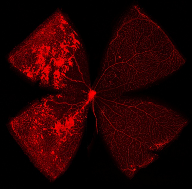 Neovascularized vs Normal Retina