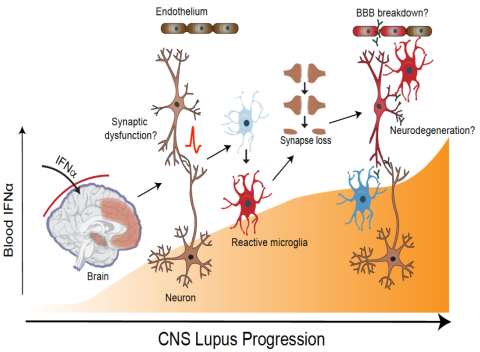 A drawing of lupus progression at a microscopic level. 