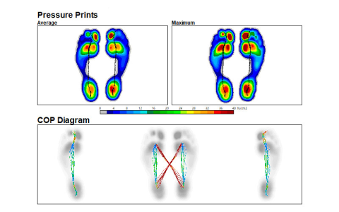 Image of gait analysis