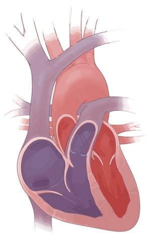 illustration of a normal heart
