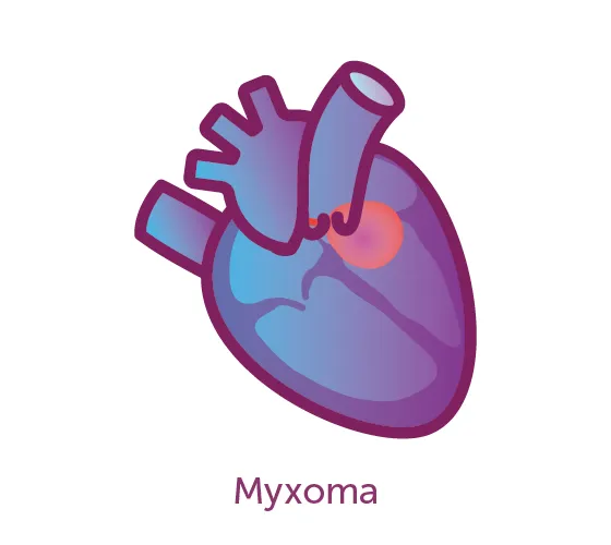 Image of a myxoma