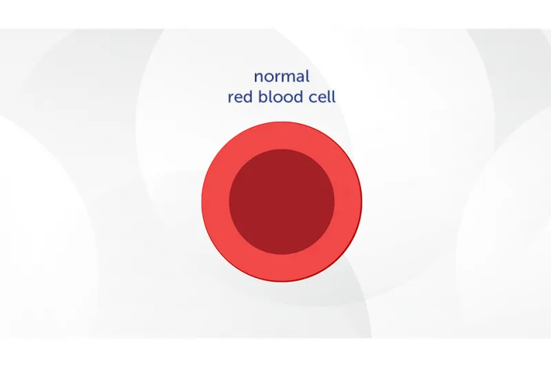 Diagram labeled "Normal red blood cell" showing a round red blood cell with a circular center.