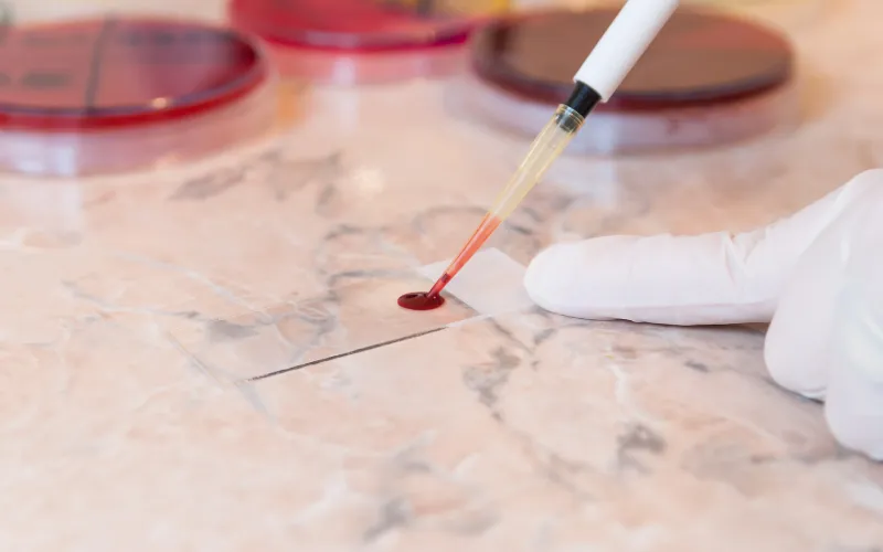 putting blood on blood slide