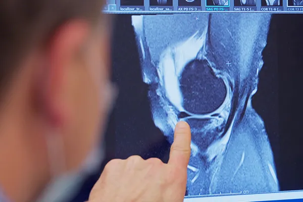 Clinician points at imagery of injured knee