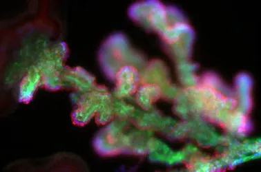 abstract pathology image