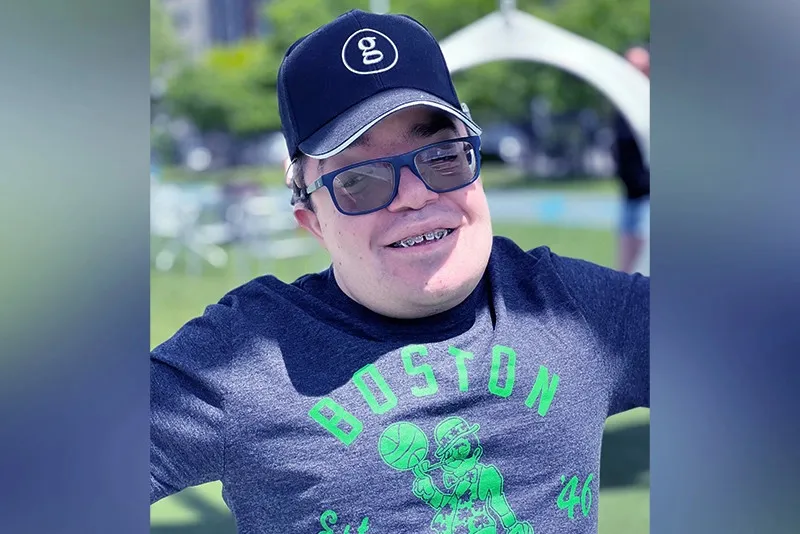 a man with crouzon syndrome smiling at the camera